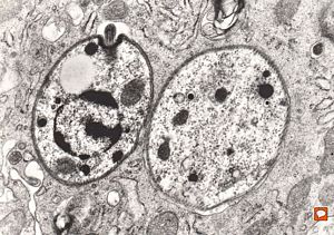 M, 28y. | leishmaniosis … skin of the cheek M, 28y. | leishmaniosis … skin of the cheek